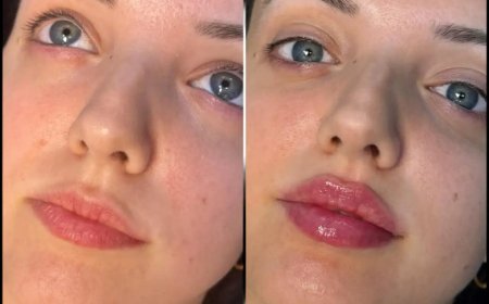 Best Aesthetic Clinics in Dubai for Fillers: Combining Treatments for Optimal Results