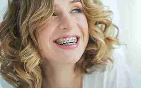 Let Your Natural Smile Shine Through Again in Ryde