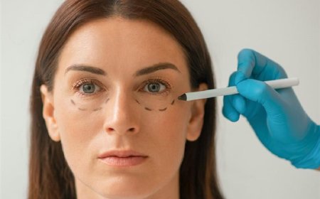 What is the best treatment for dark circles in Dubai?