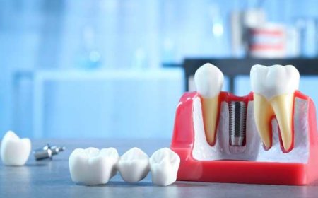 Local Care That Helps Your Smile Shine in Lancaster