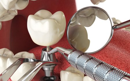 Global Dental Diagnostics and Surgical Equipment Market Set to Reach New Heights Driven by Cosmetic Dentistry and Technological Innovations