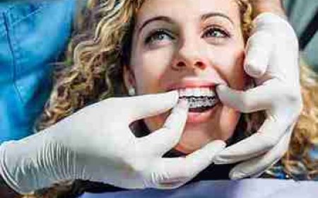 How Invisalign Solves the Most Frequent Bite Concerns