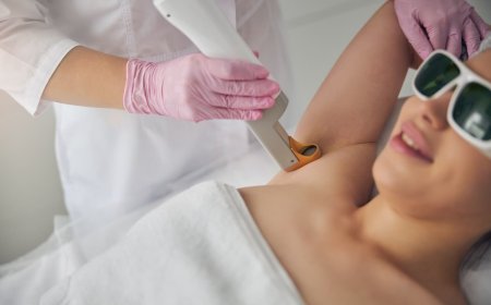 Laser Hair Removal: Is It Worth the Investment for Smooth, Hair-Free Skin?