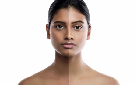 Why Whitening Injections Are a Safe Alternative to Harsh Skin Treatments