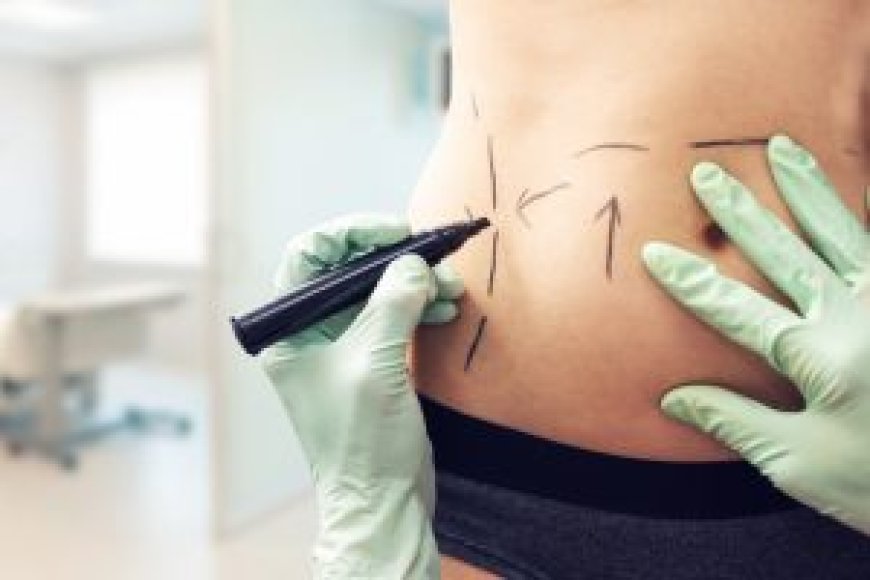 Abdominoplasty Dubai: Transform Your Body, Boost Your Confidence